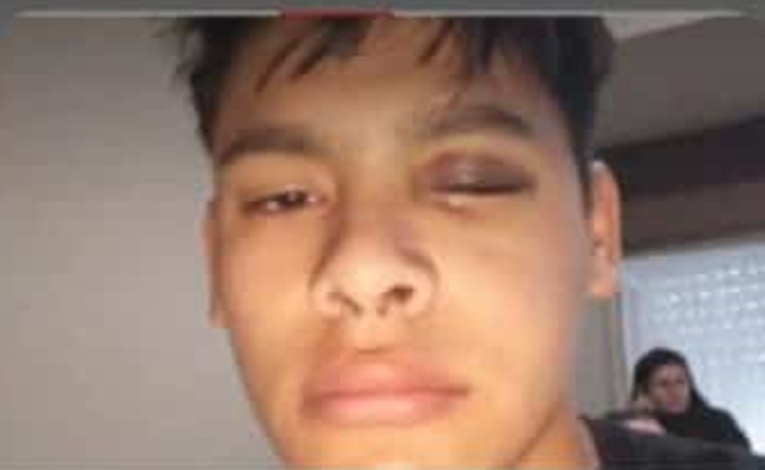 En 15 días tiene